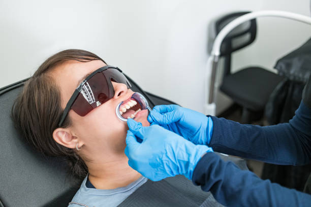 Best Urgent Care for Lost Fillings or Crowns in San Lorenzo, CA