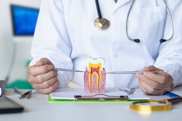 Best Emergency Treatment for Dental Infections or Abscesses in San Lorenzo, CA